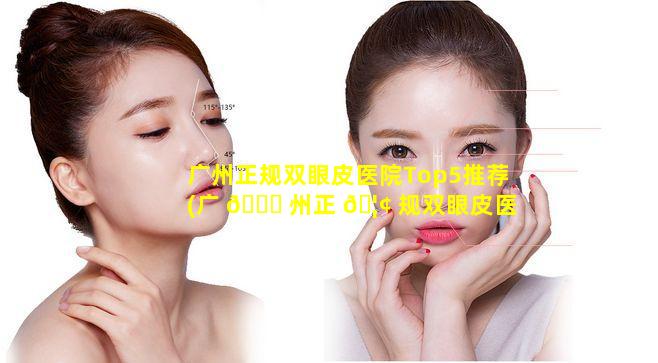 广州正规双眼皮医院Top5推荐(广 🐕 州正 🦢 规双眼皮医院top5推荐)